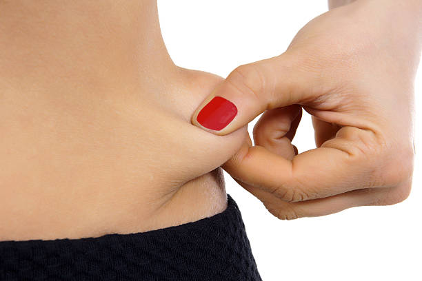 How to Get Rid of Loose Skin after Weight Loss