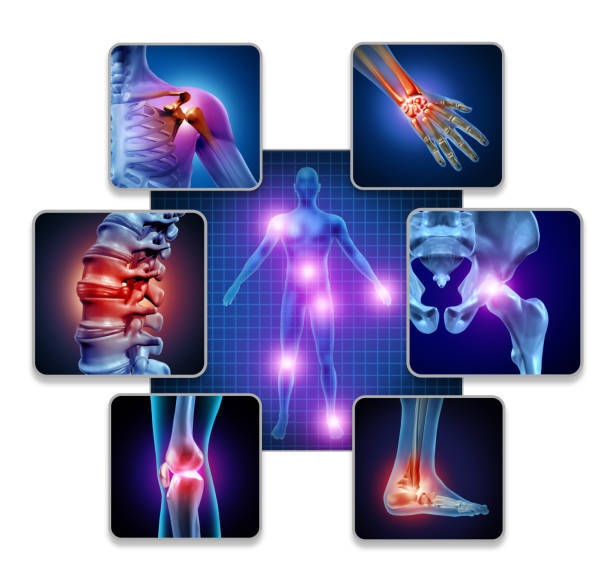 Attrities (Arthritis): Causes, Symptoms, Types, and Effective Treatment Options